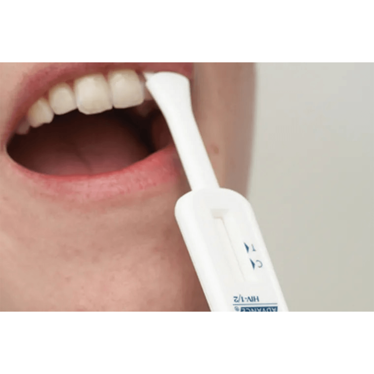 OraQuick® Advance Rapid HIV-1/2 Antibody Test - Verséa Diagnostics